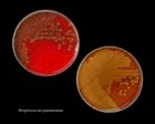 Virulent and avirulent pneumococci